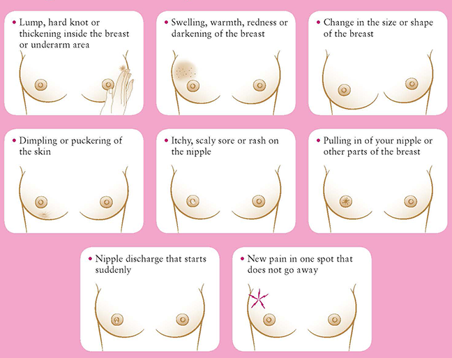 WHAT ALL WOMEN SHOULD KNOW ABOUT BREAST CANCER !